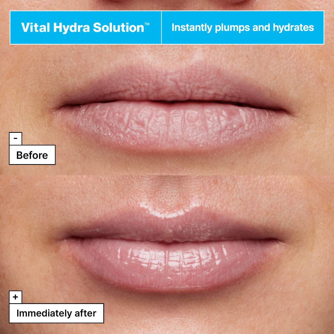 Vital Hydra Solution™ Jelly Bear Lip Mask with Hyaluronic Acid — image 2