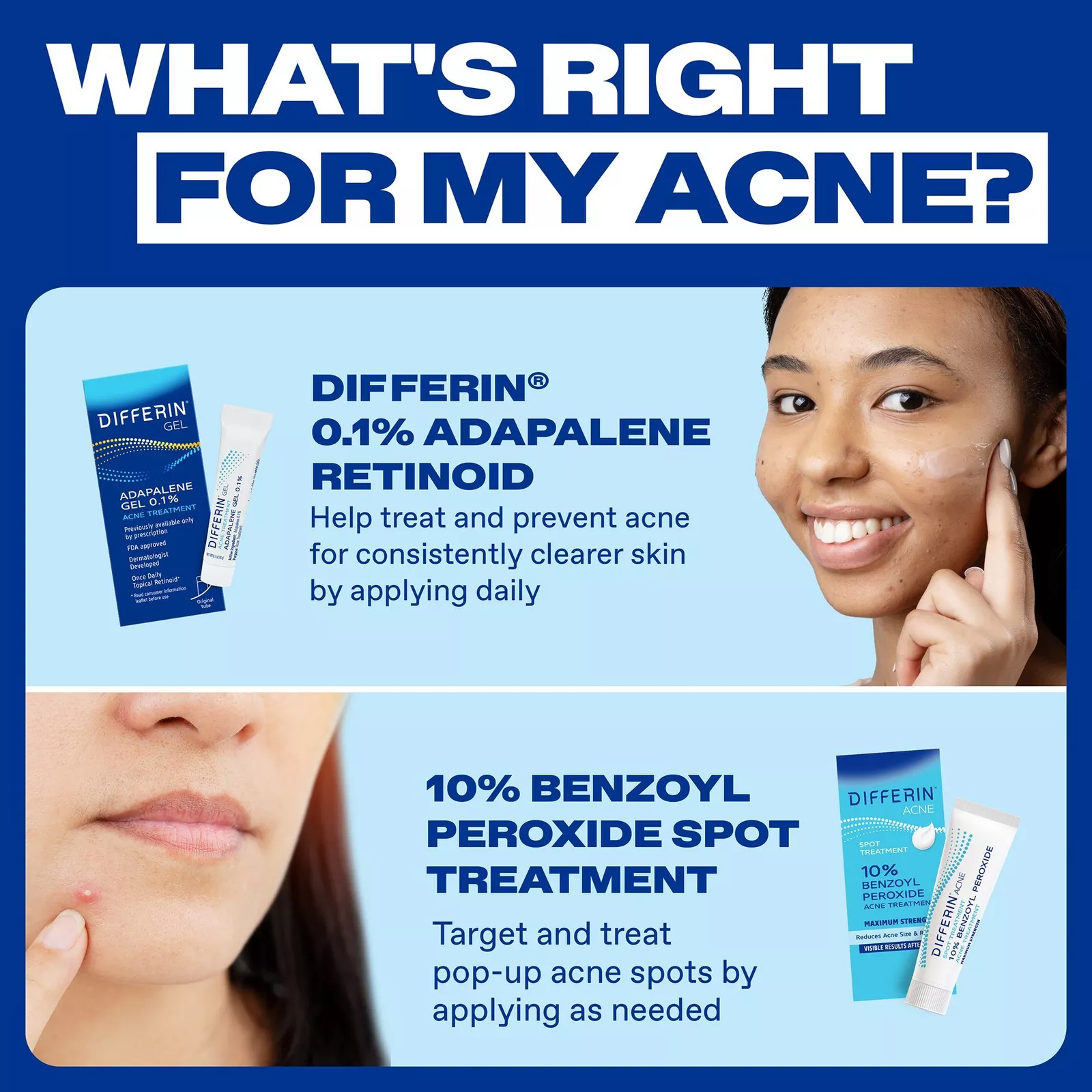 10% Benzoyl Peroxide Spot Treatment (28g) — image 8