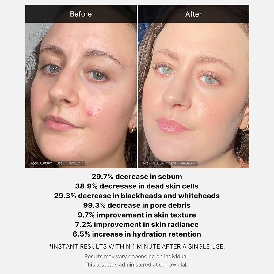 21% Acid Wash-off Exfoliant (40g) — image 8